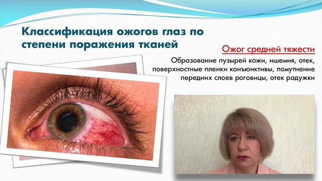 Перманентный макияж и удаление пигмента на веках. Осложнения и последствия. смотреть онлайн