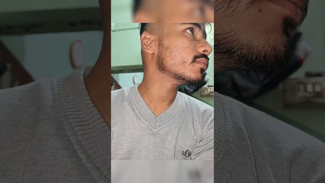my 3 months result of Minoxidil 5% for beards 🧔 ||beard journey||minoxidil video||satisfaction 😁|| смотреть онлайн