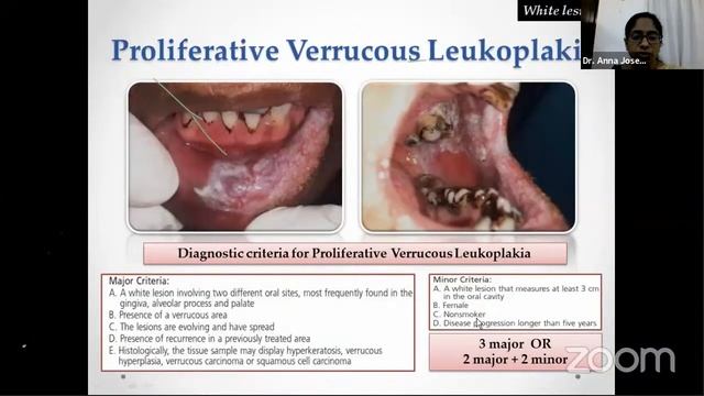 DIAGNOSIS OF ORAL LESIONS смотреть онлайн