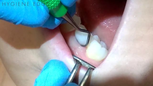 Implant Maintenance смотреть онлайн