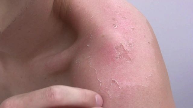 Why You Should Use Aloe Vera Daily! смотреть онлайн