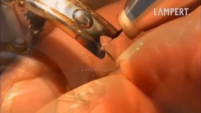 Ремонт золотого ремешка смотреть онлайн