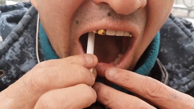 Что на до зделат чтобы не болел зуб смотреть онлайн