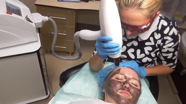 Карбоновый пилинг! смотреть онлайн