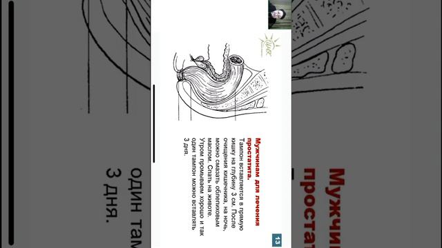 Использование тампонов Fohow