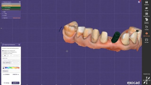 Разборная модель с аналогами имплантов в программе Exocad для 3D печати смотреть онлайн
