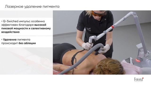 Лазерное удаление пигментации с помощью Fotona StarWalker смотреть онлайн
