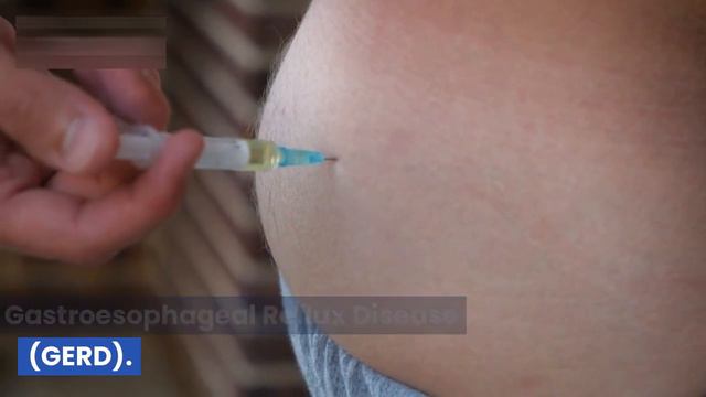 The 3 causes of constant mucus (phlegm) in the throat смотреть онлайн