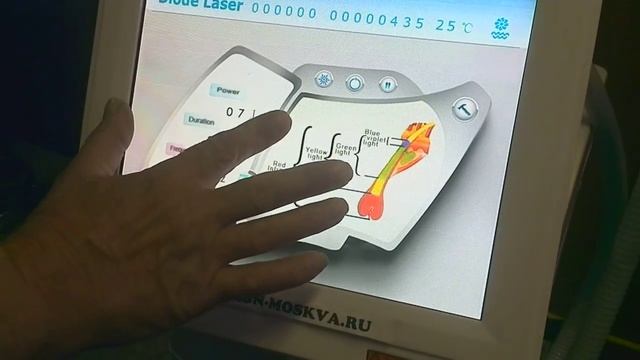 Лазерная эпиляция аппаратом Honkon 808 Al