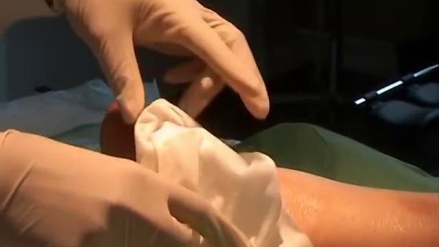 Maggot Debridement.mpg смотреть онлайн