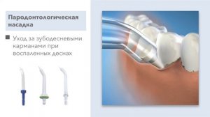 Принцип работы ирригатора