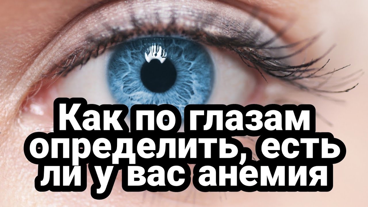 Как по глазам определить, есть ли у вас анемия смотреть онлайн