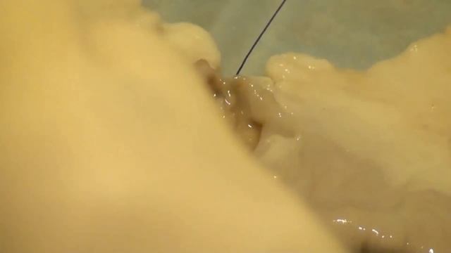 Однорядный кишечный шов смотреть онлайн