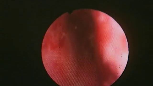 The Nasal Septum смотреть онлайн