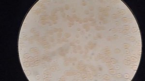 Как ТАВОЛГА влияет на кровь. Большой эксперимент