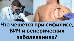 Что чешется при сифилисе, вич и иппп?