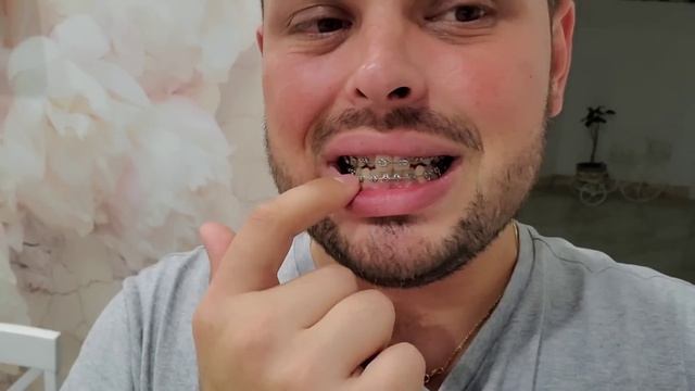 Приехал к маме ! Опухла нога ! Вкусная жарена картошка смотреть онлайн