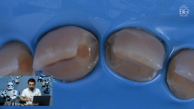 Препарирование в раббердаме. Какие есть преимущества? Дентал Кейсы от BG. #05 смотреть онлайн