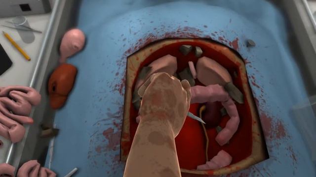 Surgeon Simulator #2 Пересадка Почек:D смотреть онлайн