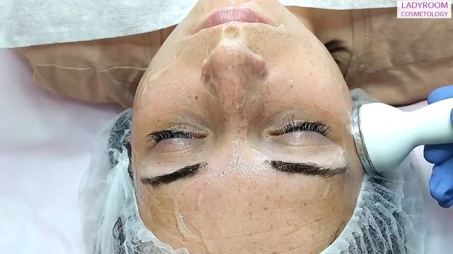ПРОЦЕДУРА УЛЬТРАФОНОФОРЕЗА | LADYROOM смотреть онлайн
