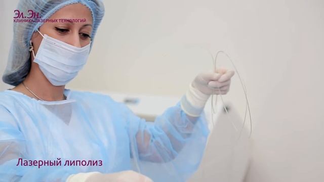 Лазерный липолиз на аппарате SmartLipo (DEKA) Италия смотреть онлайн