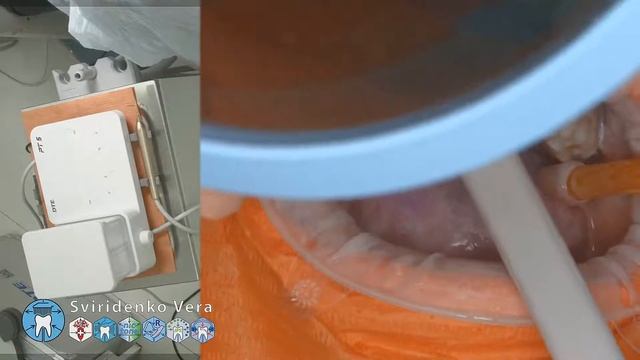 Professional oral hygiene -case 019 Acteon DTE Dentsply Coxo Floweis 3M KerrHawe (FHD multistream) смотреть онлайн