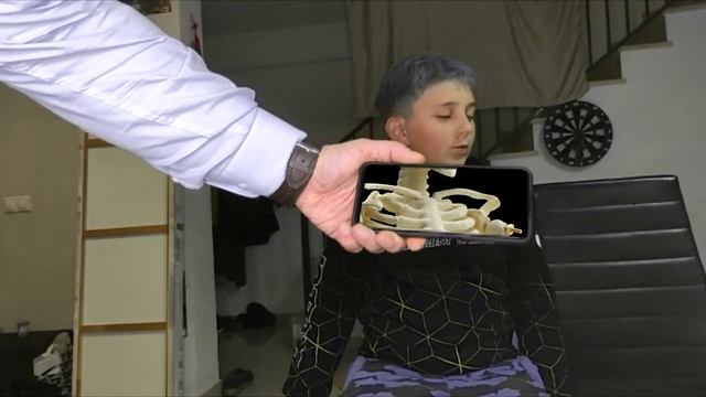 Рентген на моём телефоне смотреть онлайн