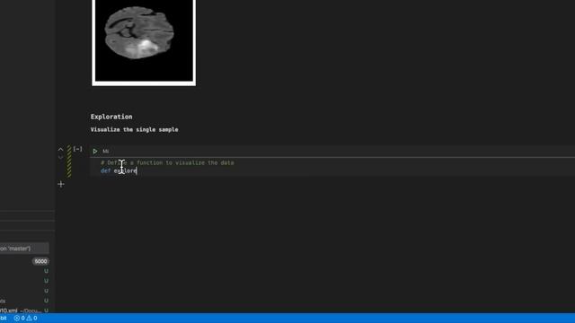 Neuroimaging: Visualize 3D MRI Brain Scans with Python смотреть онлайн