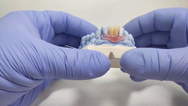 Временный нейлоновый протез смотреть онлайн