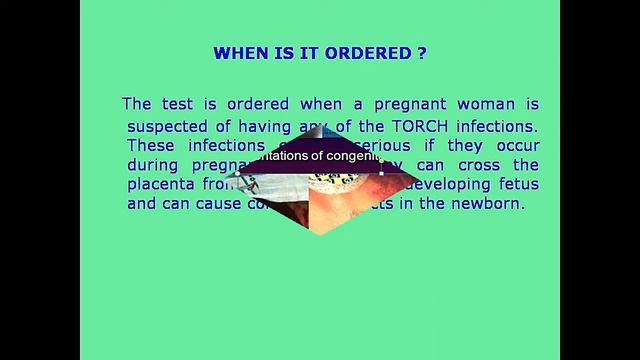 DIAGNOSIS OF TORCH смотреть онлайн