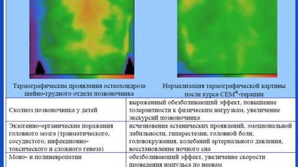 Возможности аппаратов CEM-TECH