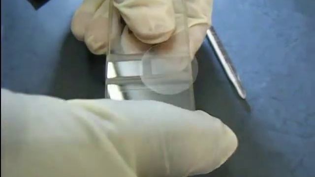 Haematology White Blood Cell Count смотреть онлайн