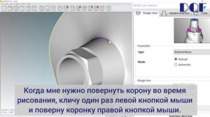 Как отрегулировать положение абатмента в гиперДенте