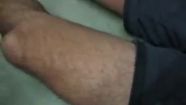 Bullet Ant Sting смотреть онлайн