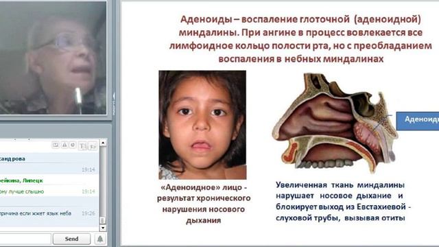 НЗ Причины заболевания полости рта Н,Г,Байкулова ( 2016 01 14 ) смотреть онлайн