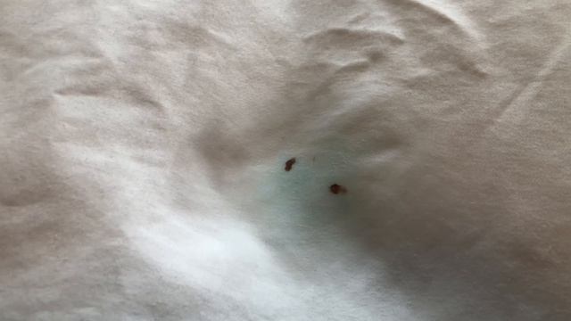 REMOVE BLOOD STAINS FROM BED SHEETS - HOW TO смотреть онлайн