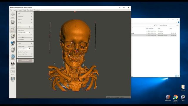 Creating 3D Printable Medical Models for Free: Embodi3D.com, 3D Slicer, and Meshmixer смотреть онлайн