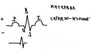 Основы ЭКГ | сегменты, интервалы и зубцы | Нормальная физиология