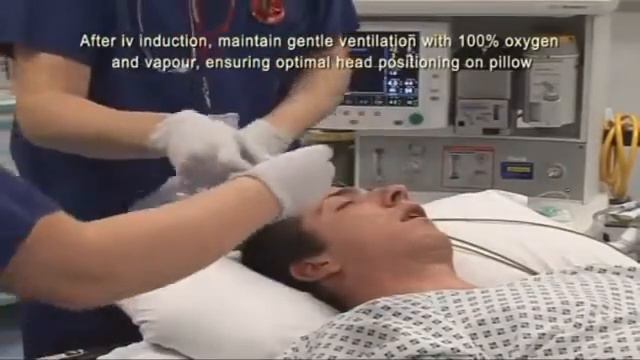 Интубация трахеи смотреть онлайн