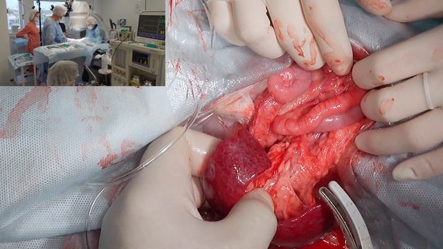 Асцит лечение у собаки . смотреть онлайн