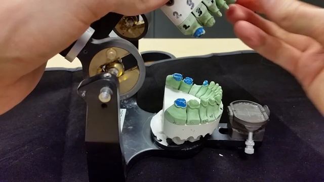 Derek B Gatta DMD Secrets To Articulating The Full Mouth REHAB! #Dentistry