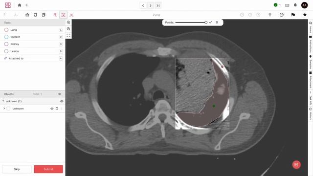 Labeling Medical Data on Ango Hub - Walkthrough смотреть онлайн