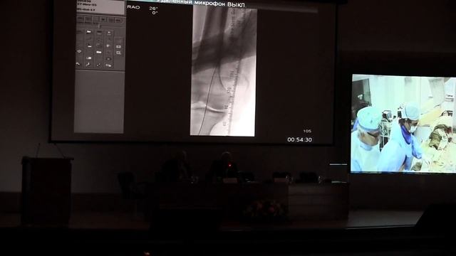 VI съезд РНОИК. On line трансляции Рентгенэндоваскулярных процедур2 смотреть онлайн