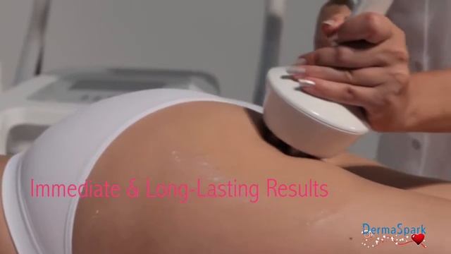 Pollogen Face And Body Treatments - Mother's Day Video