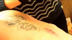 Выдавливание прыщей. ТАКИЕ ПРЫЩИ ВЫ ЕЩЕ НЕ ВИДЕЛИ (хоть на хлеб мажь))