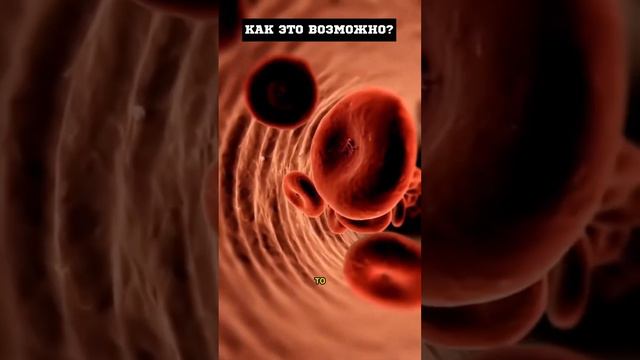 Сердце в правой части груди, как это возможно? #здоровье #медицина смотреть онлайн