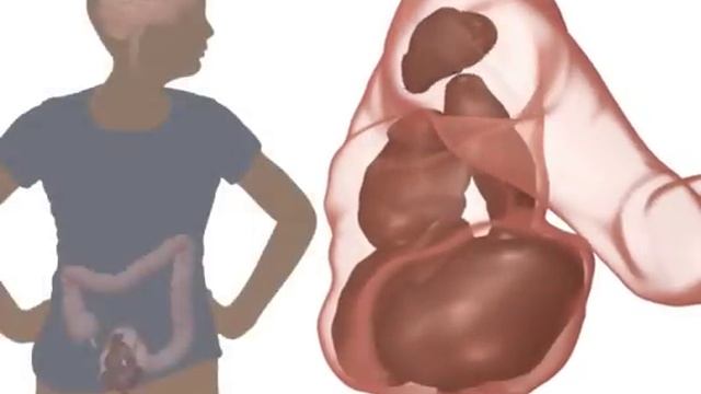 The Poo in You - Constipation and Encopresis Educational Video смотреть онлайн