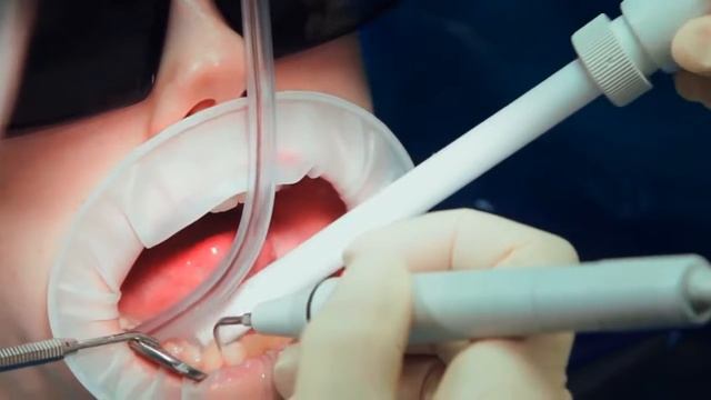 Как ухаживать за полостью рта смотреть онлайн