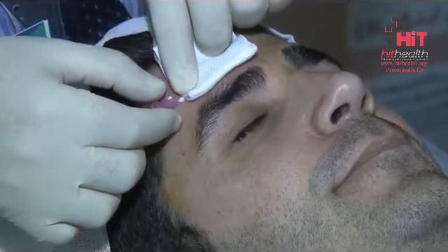 Forehead- DARVIN - Happy Lift смотреть онлайн