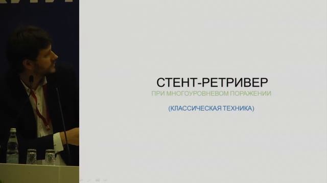 Д.В. Скрыпник, Эндоваскулярное лечение ишемического инсульта в Москве. смотреть онлайн